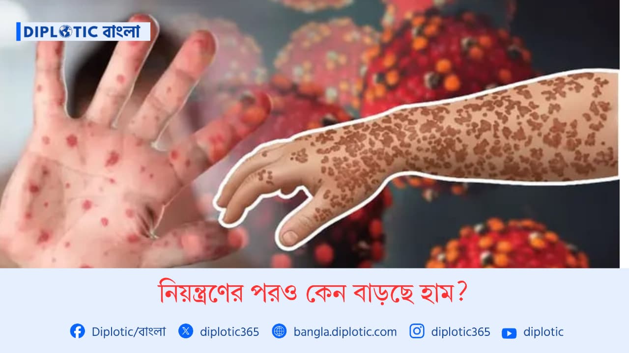নিয়ন্ত্রণের পরও কেন বাড়ছে হাম?